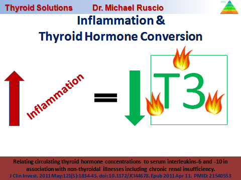 inflammation_&_thyroid hormone_conversion