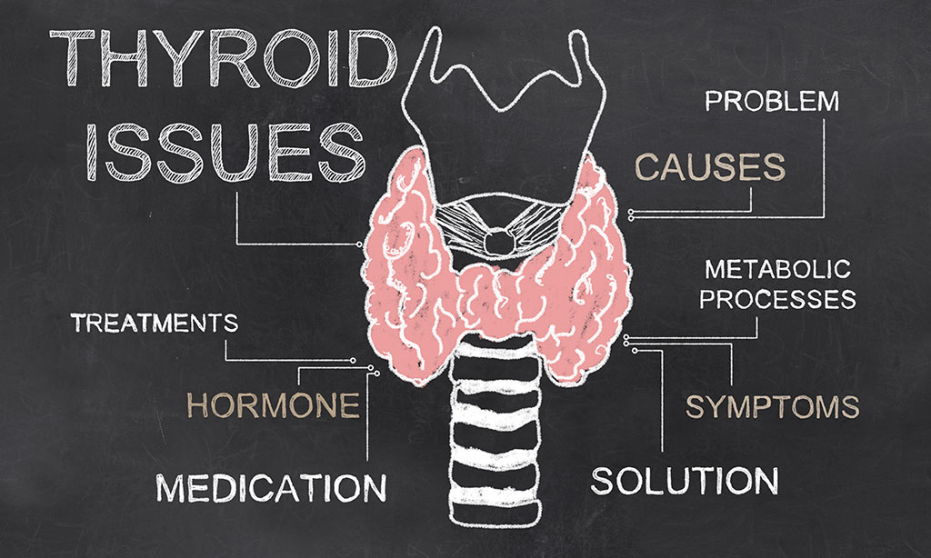Still Having Thyroid Issues? This May Be Why