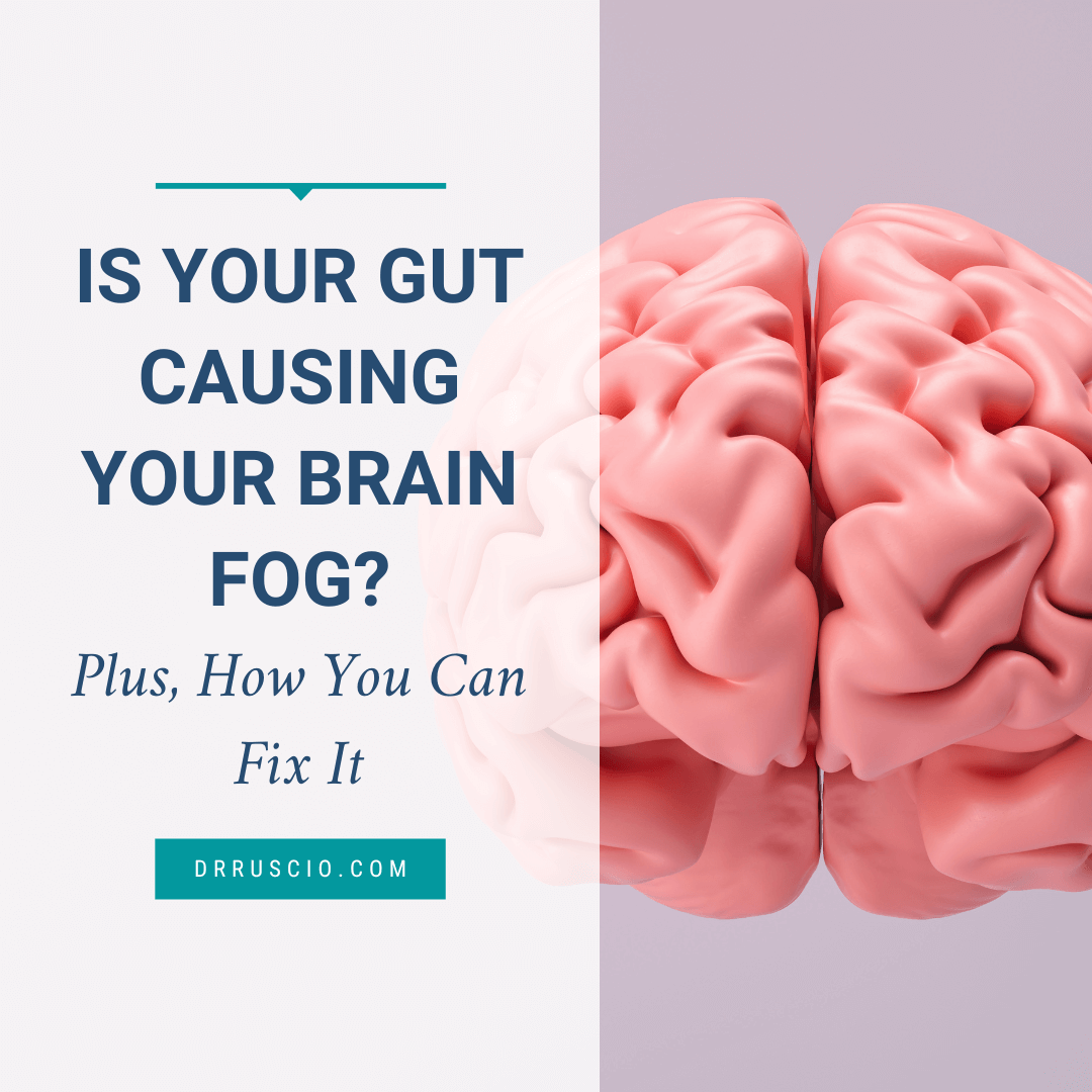 Is Your Gut Causing Your Brain Fog? Plus, How You Can Fix It