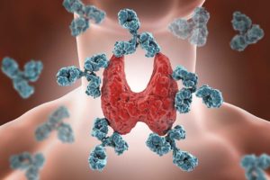 Healthy Levels of Thyroid Antibodies