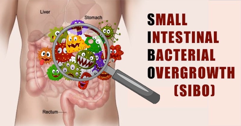 My SIBO Treatment Protocol