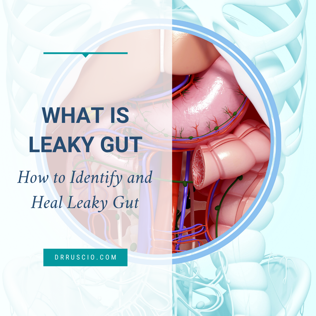 What is Leaky Gut