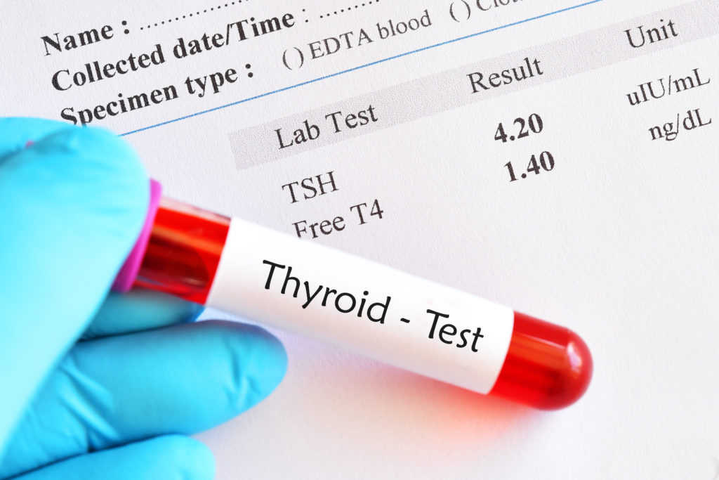 What does the thyroid do: A gloved hand holds a thyroid lab test sample