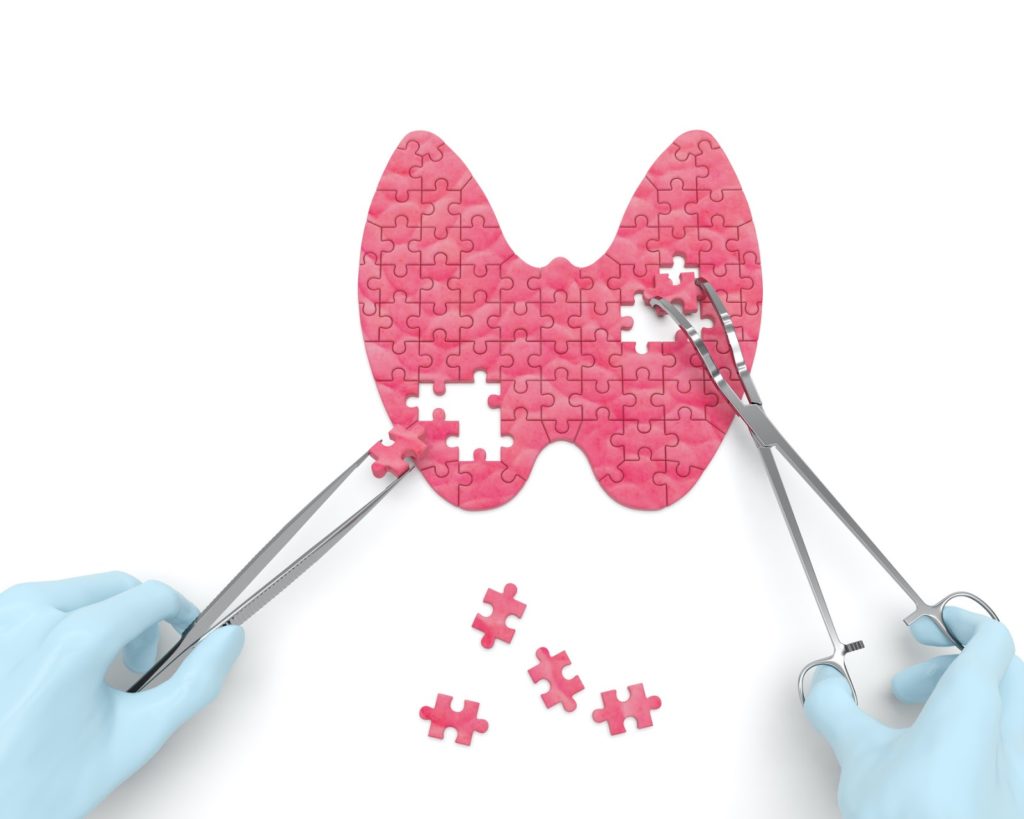 Thyroid supplements: A doctor assembles a puzzle shaped like a thyroid using forceps