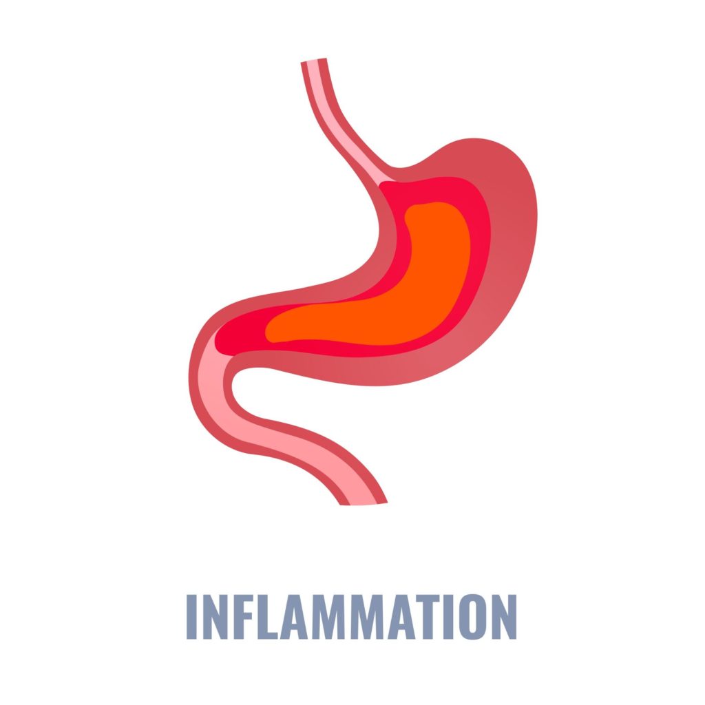 inflammation