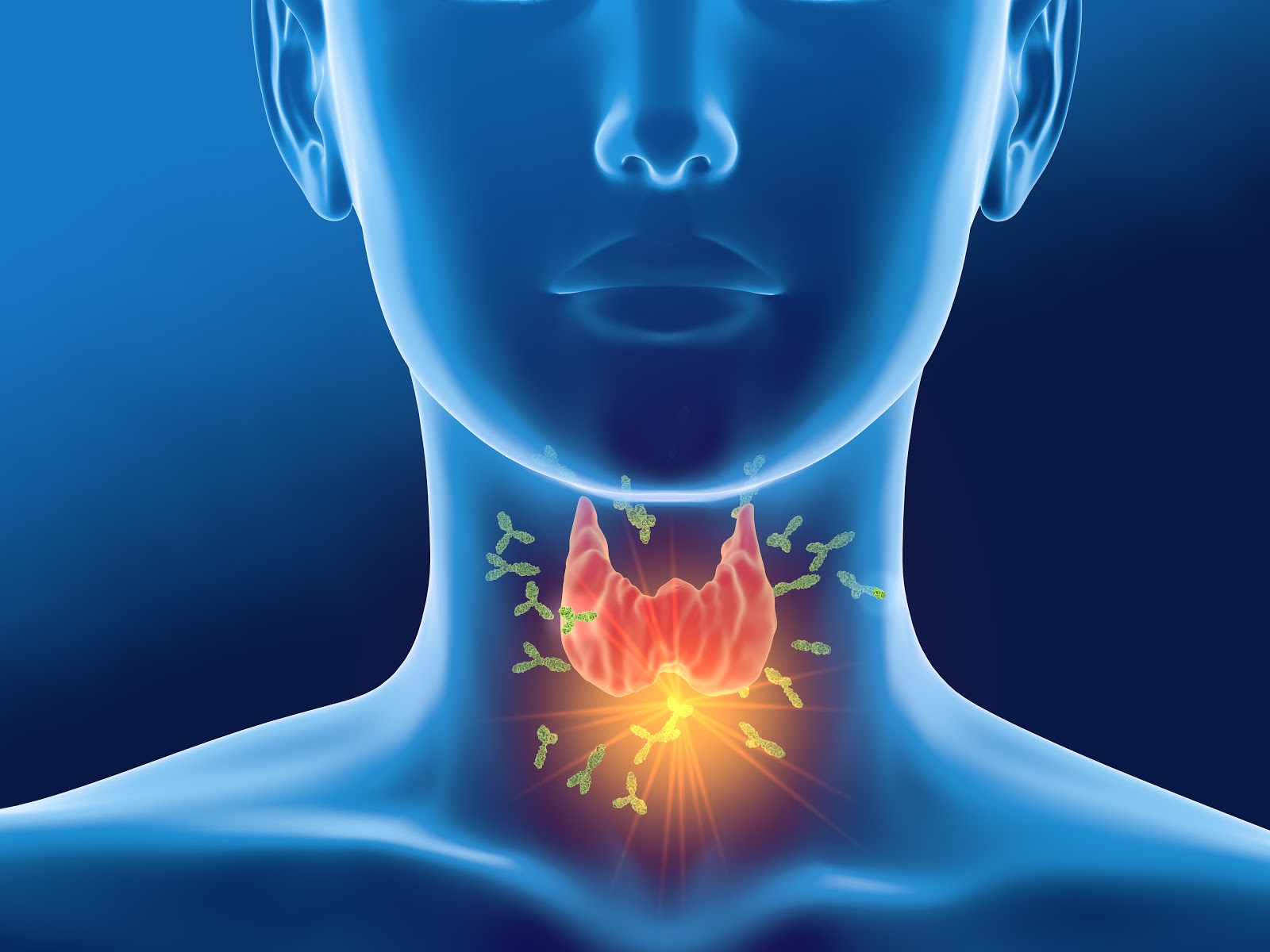 Symptoms of Hashimoto's Flare up: Antibodies attacking thyroid gland of a woman