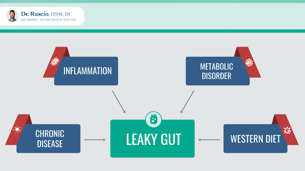 leaky gut supplements: boxes listing the causes of leaky gut