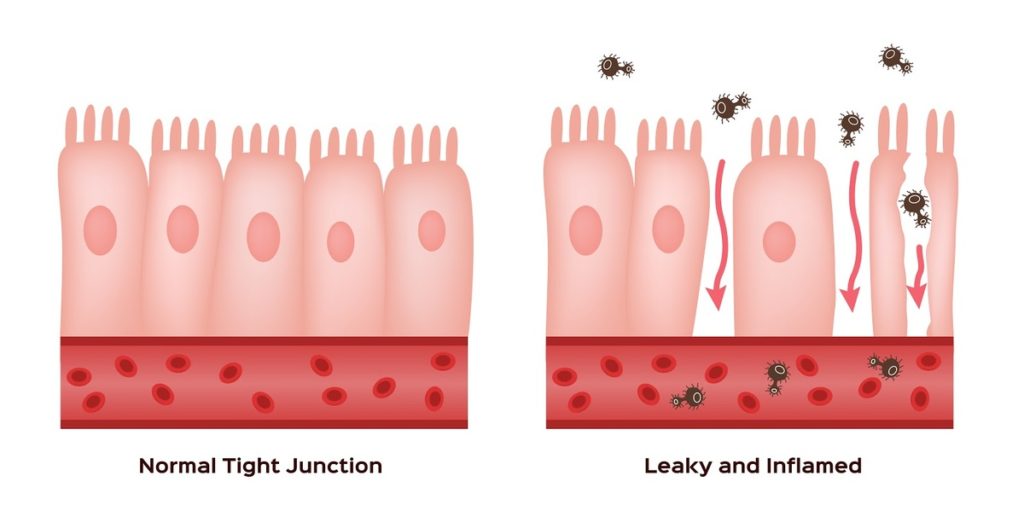 Illustration of normal and damaged small intestine lining