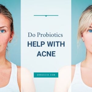 Do Probiotics Help With Acne?