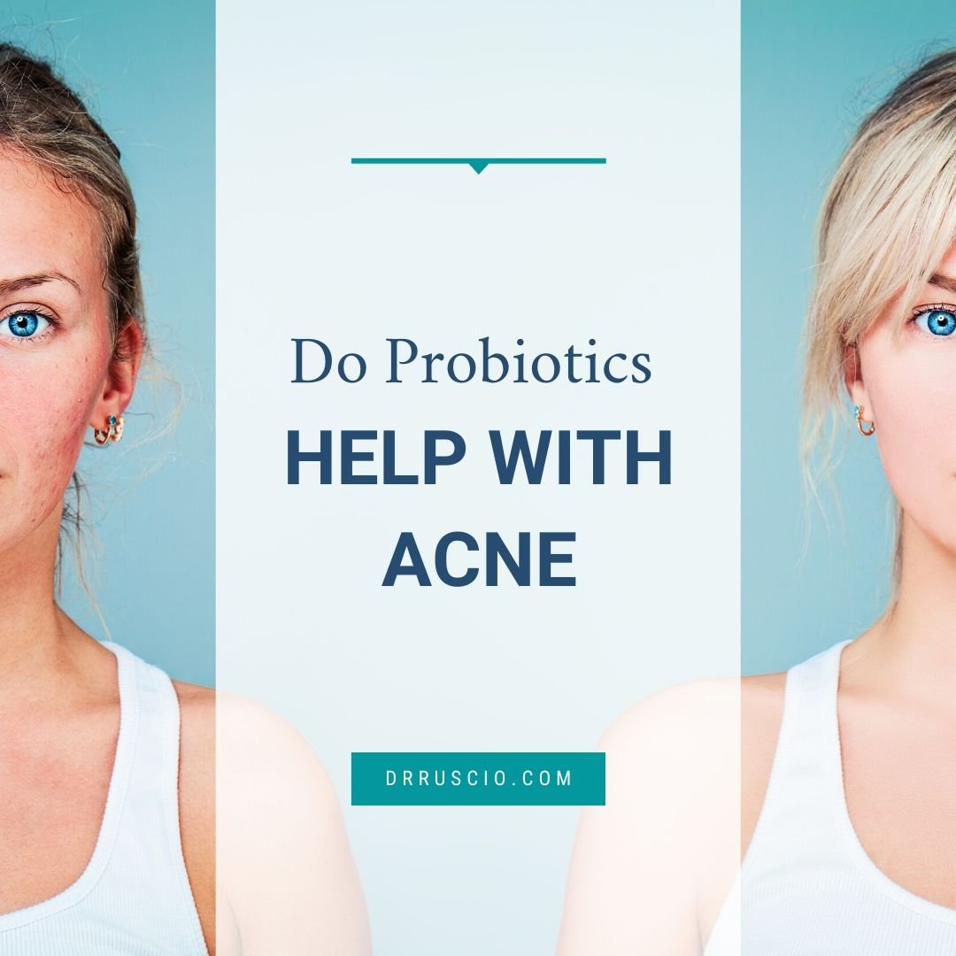 Do Probiotics Help With Acne? - Dr. Michael Ruscio, BCDNM, DC