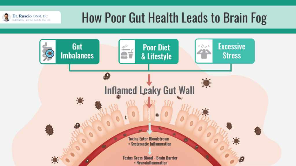 Diagram showing how poor gut health leads to brain fog