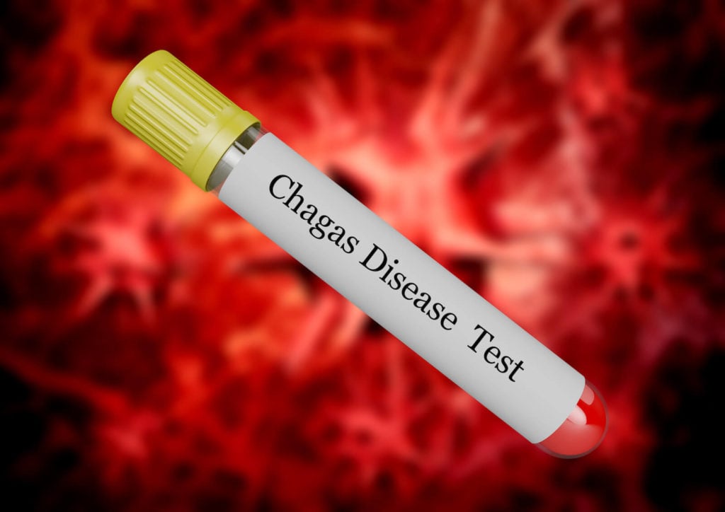 Protozoan parasite: Chagas Disease test