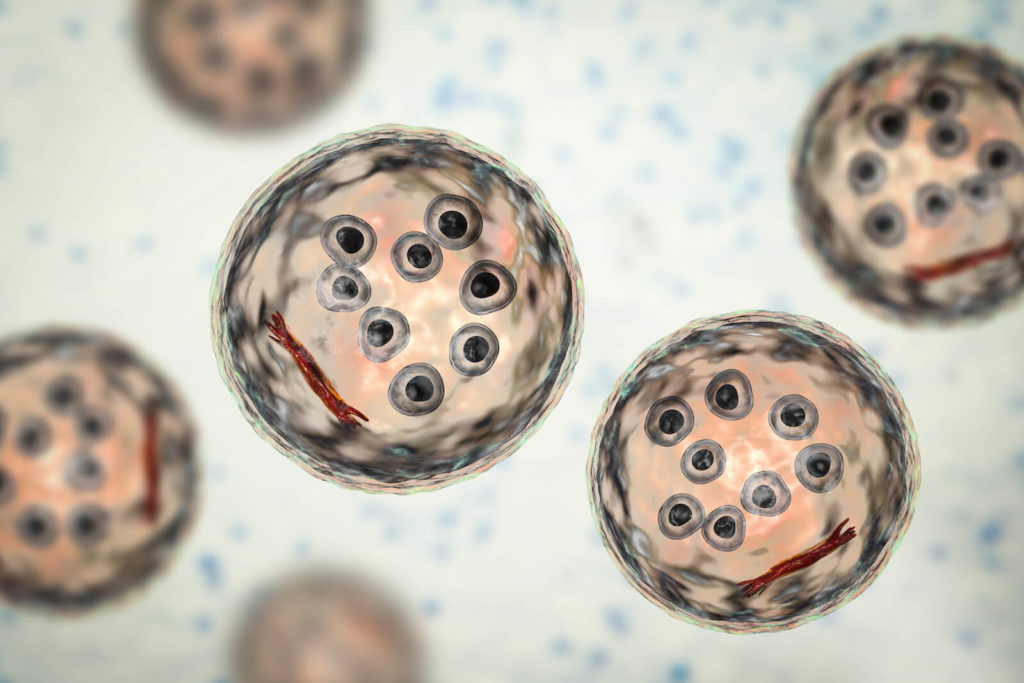 Gut biome test: 3D illustration of a cyst