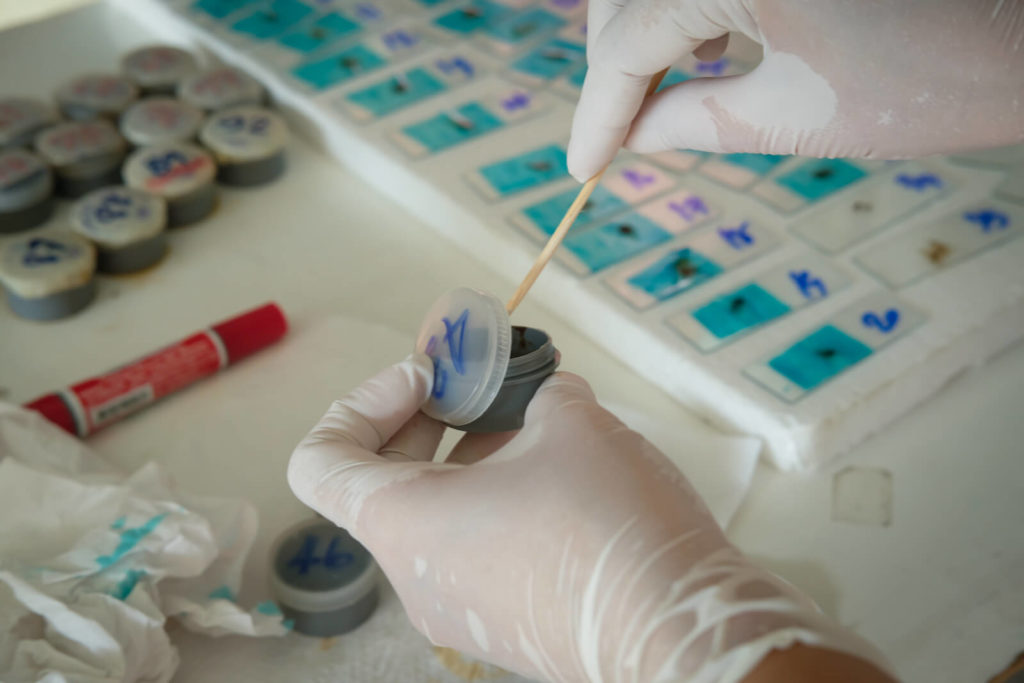Lab tech doing stool test