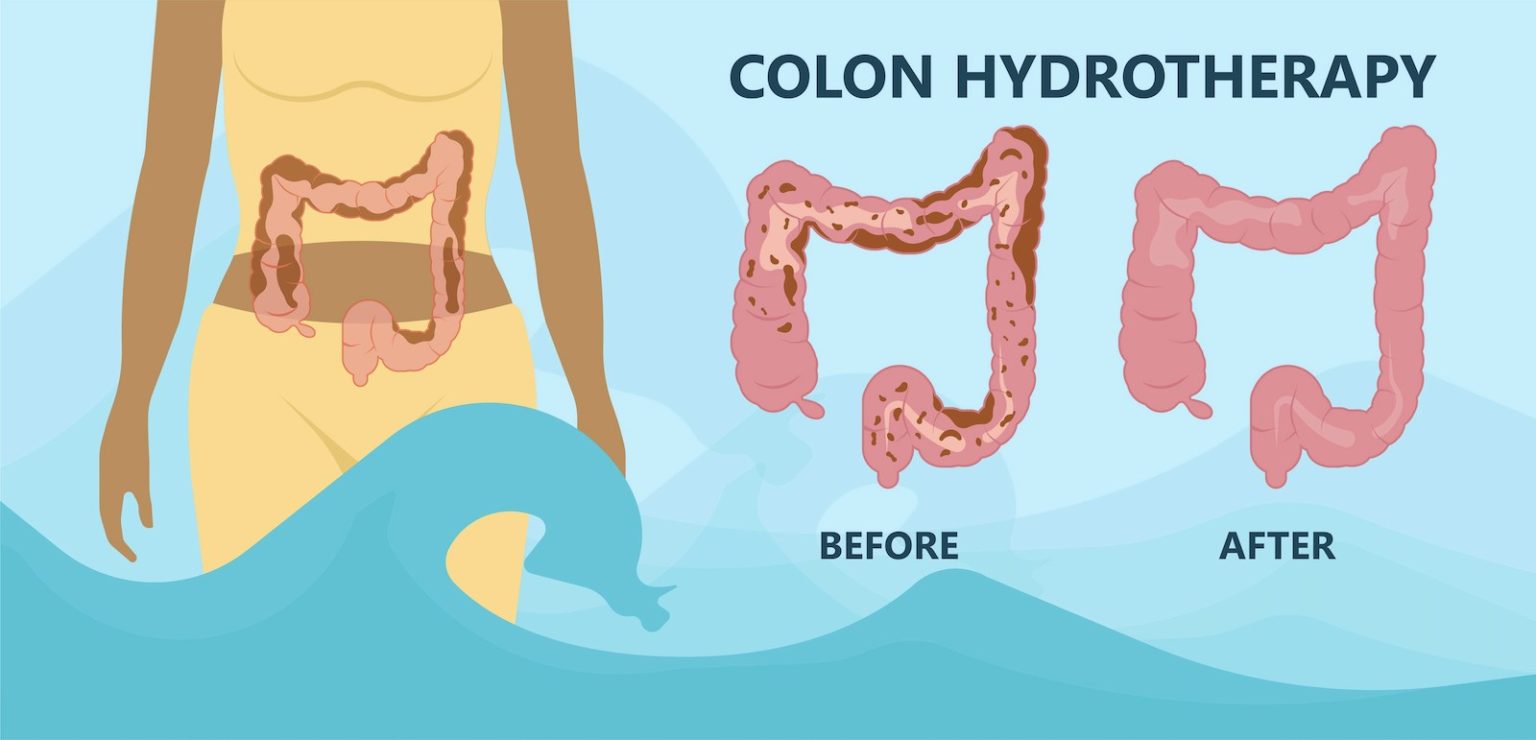 everything-about-colon-hydrotherapy-how-much-weight-loss-we-can-get