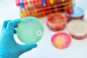 Antimicrobial vs. Antibiotic: Which Is Best for Healing Your Gut?