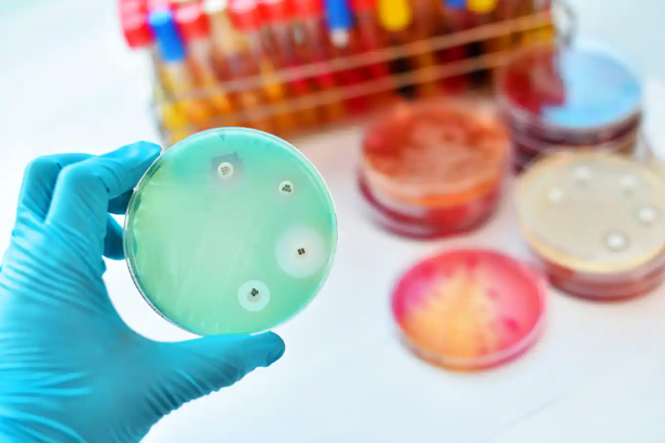 Antimicrobial vs. Antibiotic: Which Is Best for Healing Your Gut?