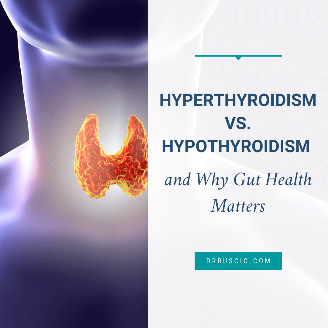 Hyperthyroidism vs. Hypothyroidism