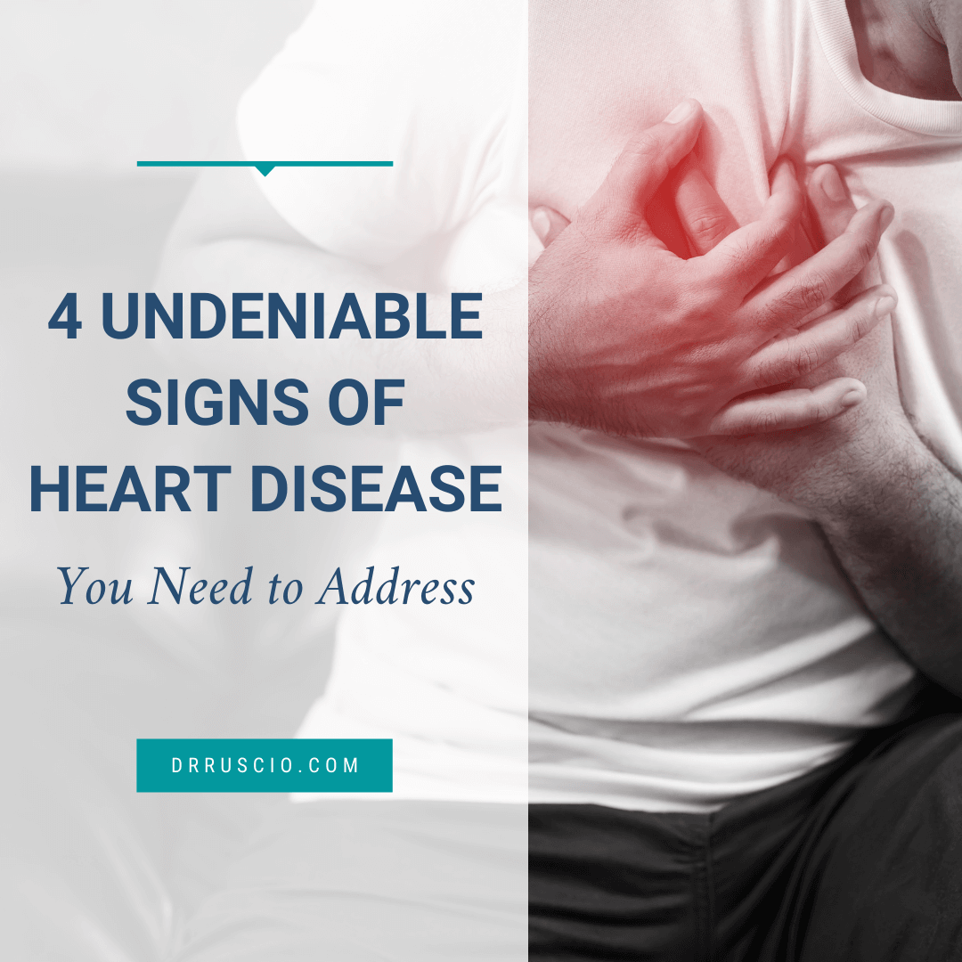 4 Undeniable Signs of Heart Disease You Need to Address