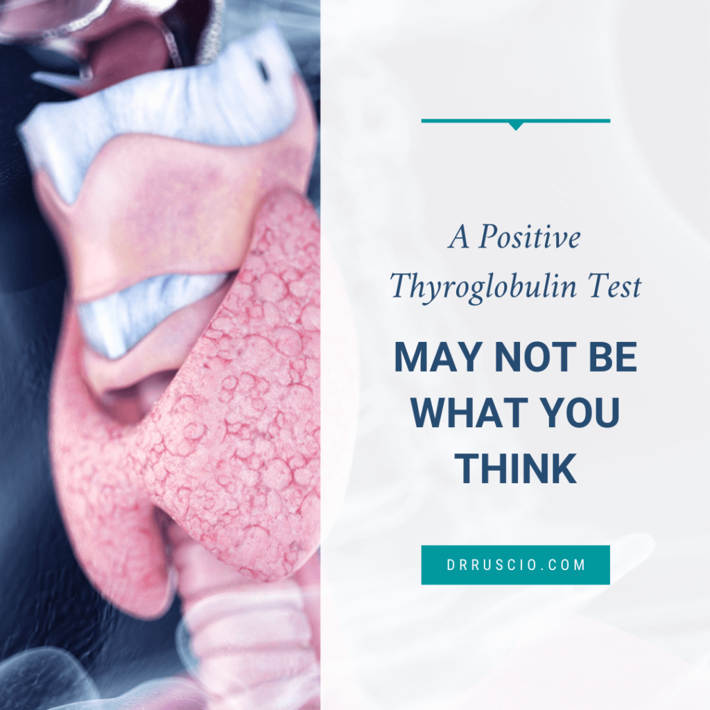 A Positive Thyroglobulin Test May Not Be What You Think - Monday Wednesday Featured Image Blog 1 2