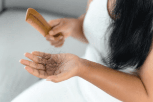 Can Vitamin D Deficiency Cause Hair Loss?