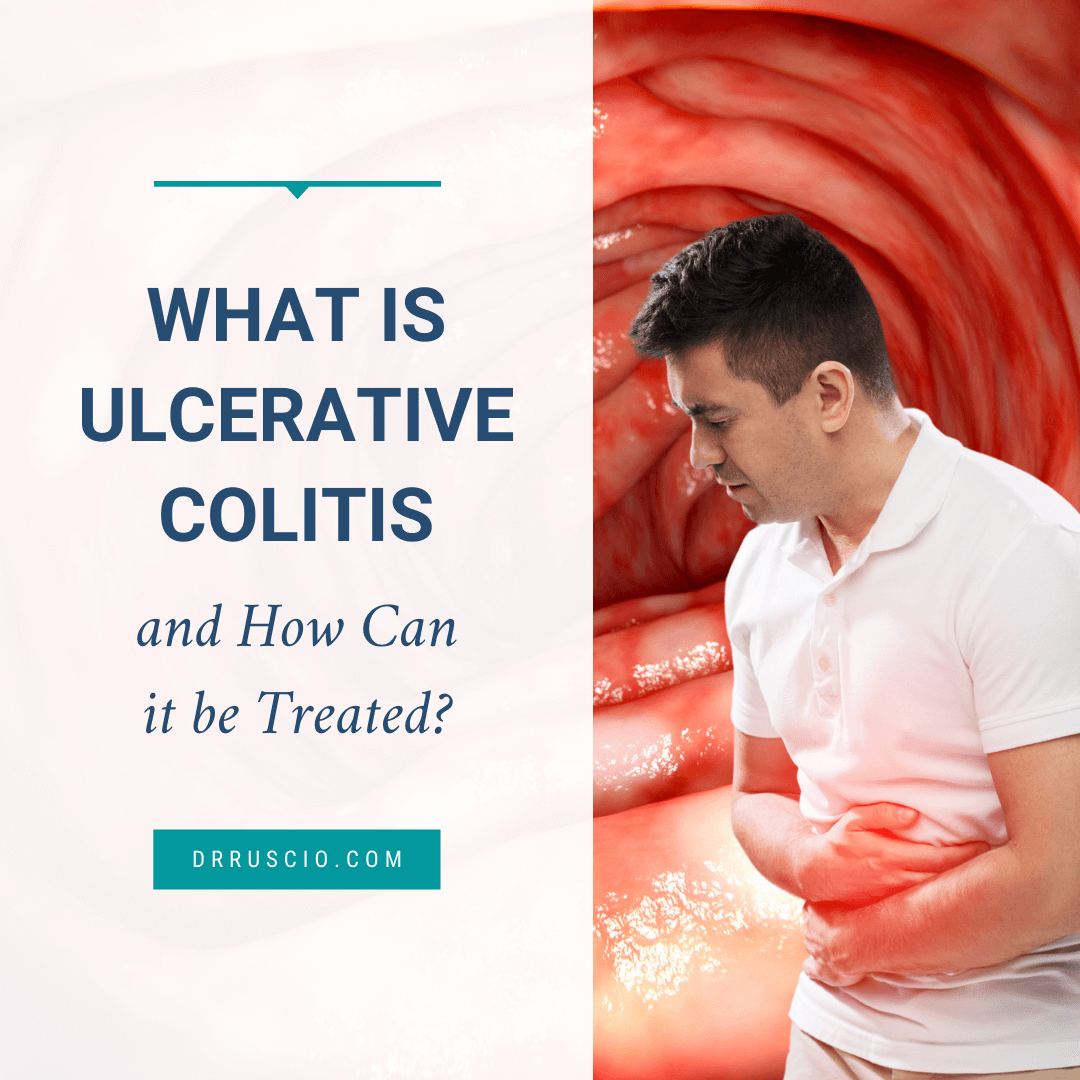 What is Ulcerative Colitis and How Can it be Treated?