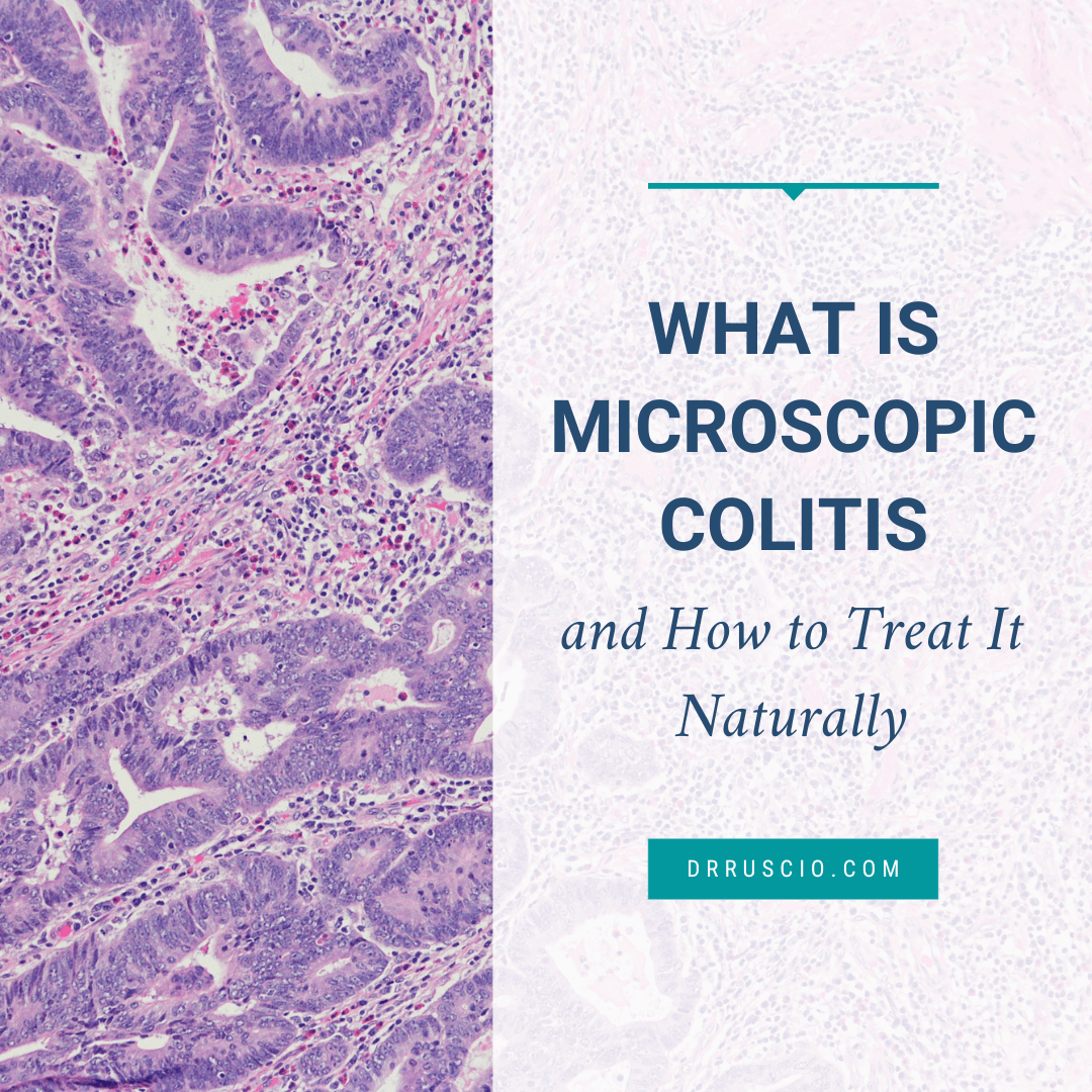 what-is-microscopic-colitis-and-how-to-treat-it-naturally-dr-michael