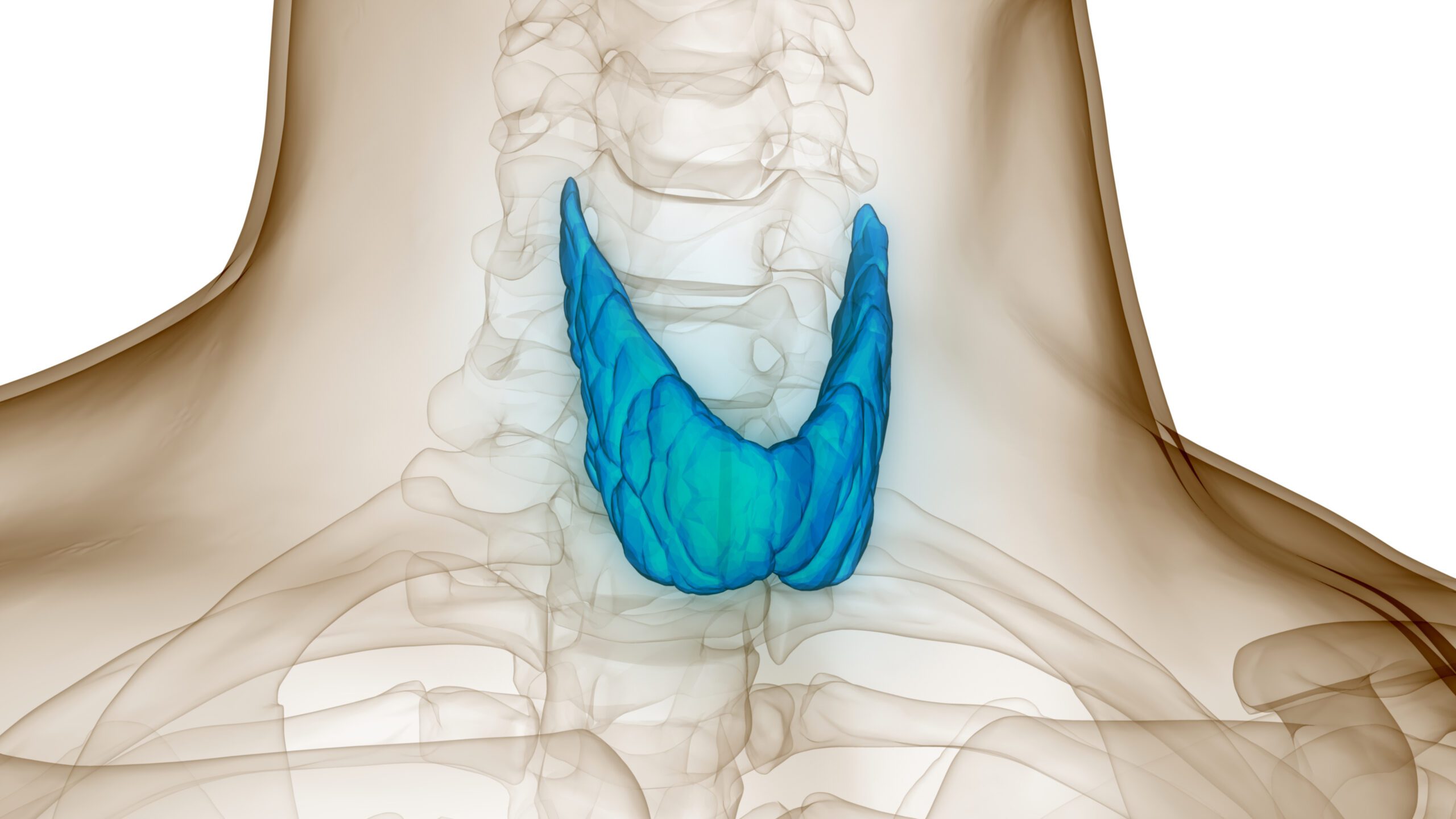 What is Subclinical Hypothyroidism?