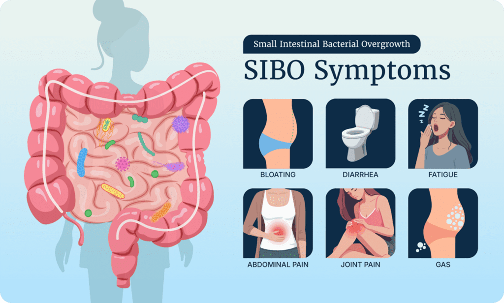 Infographic illustrating the symptoms of SIBO (Small Intestinal Bacterial Overgrowth). The list includes bloating, diarrhea, fatigue, abdominal pain, joint pain, and gas.